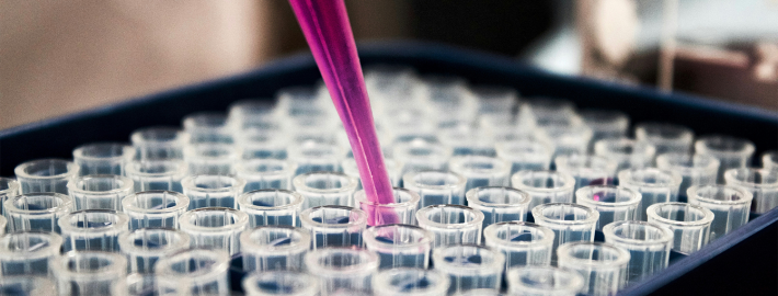 A close-up view of a laboratory setting, showcasing a pipette dispensing a liquid into one of the many small, clear tubes arranged in a tray. The tray is dark blue, and the background is blurred, emphasizing the precision of the experiment in progress.