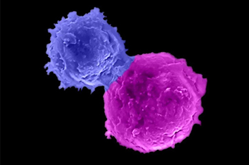 A microscopy image shows an enhanced natural killer T cell (blue) attacking a human multiple myeloma cell (magenta).