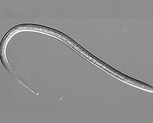 A microscopic image of an S. stercoralis nematode against a gray background.