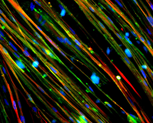 Colorful strands showing restoration of dystrophin (stained green) in Duchenne muscular dystrophy muscle cells