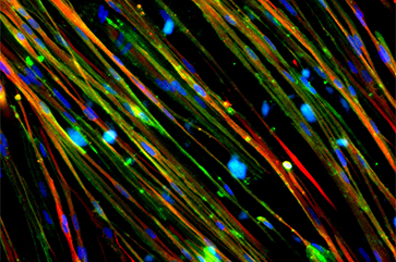 Colorful strands showing restoration of dystrophin (stained green) in Duchenne muscular dystrophy muscle cells