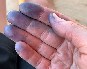 Hand with blue pigment on fingertips