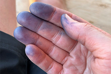 Hand with blue pigment on fingertips